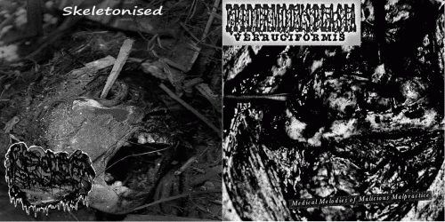 Pseudomonas Aeruginosa : Pseudomonas Aeruginosa - Epidermodysplasia Verruciformis